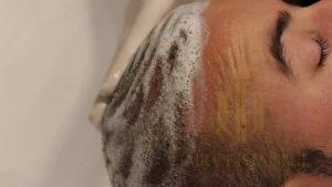 how to remove scabs after hair t 4