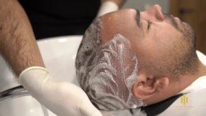 how to wash your hair after hair transplant