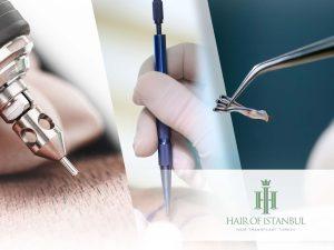 Istanbul Hair Transplant Guide: 2025 Roadmap for Safe, Natural Results 5 DHI and FUE Method