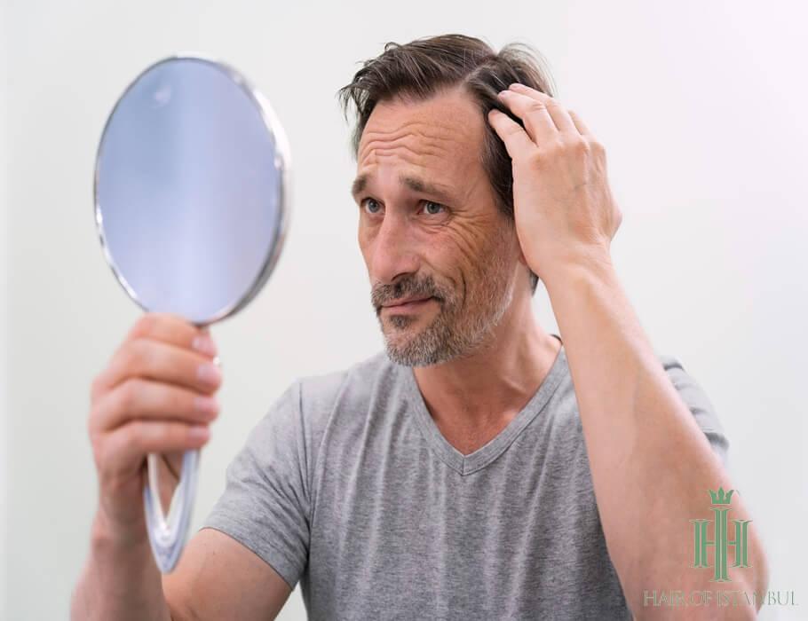 My Hair Is So Thin, I Can See My Scalp! Is Something Wrong?