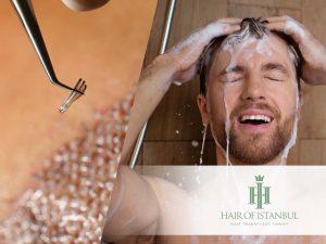 After Hair Transplant Scalp Hygiene: The Foundation for Healthy Recovery 4 When Can I Wash My Hair