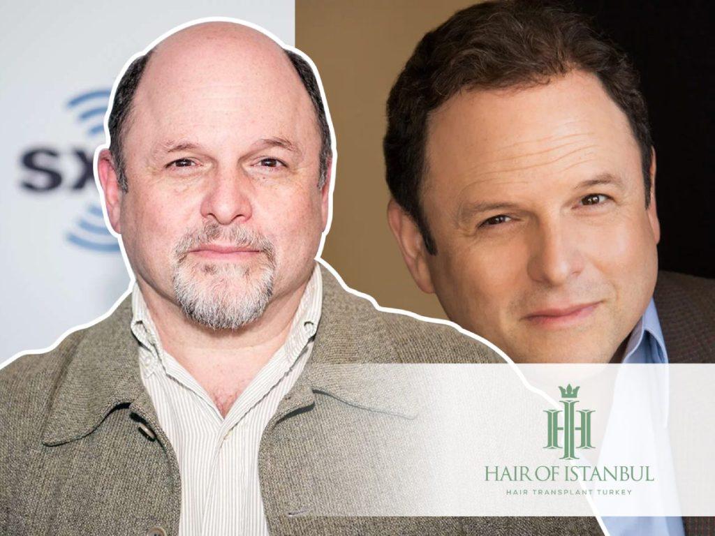 Jason Alexander Hair