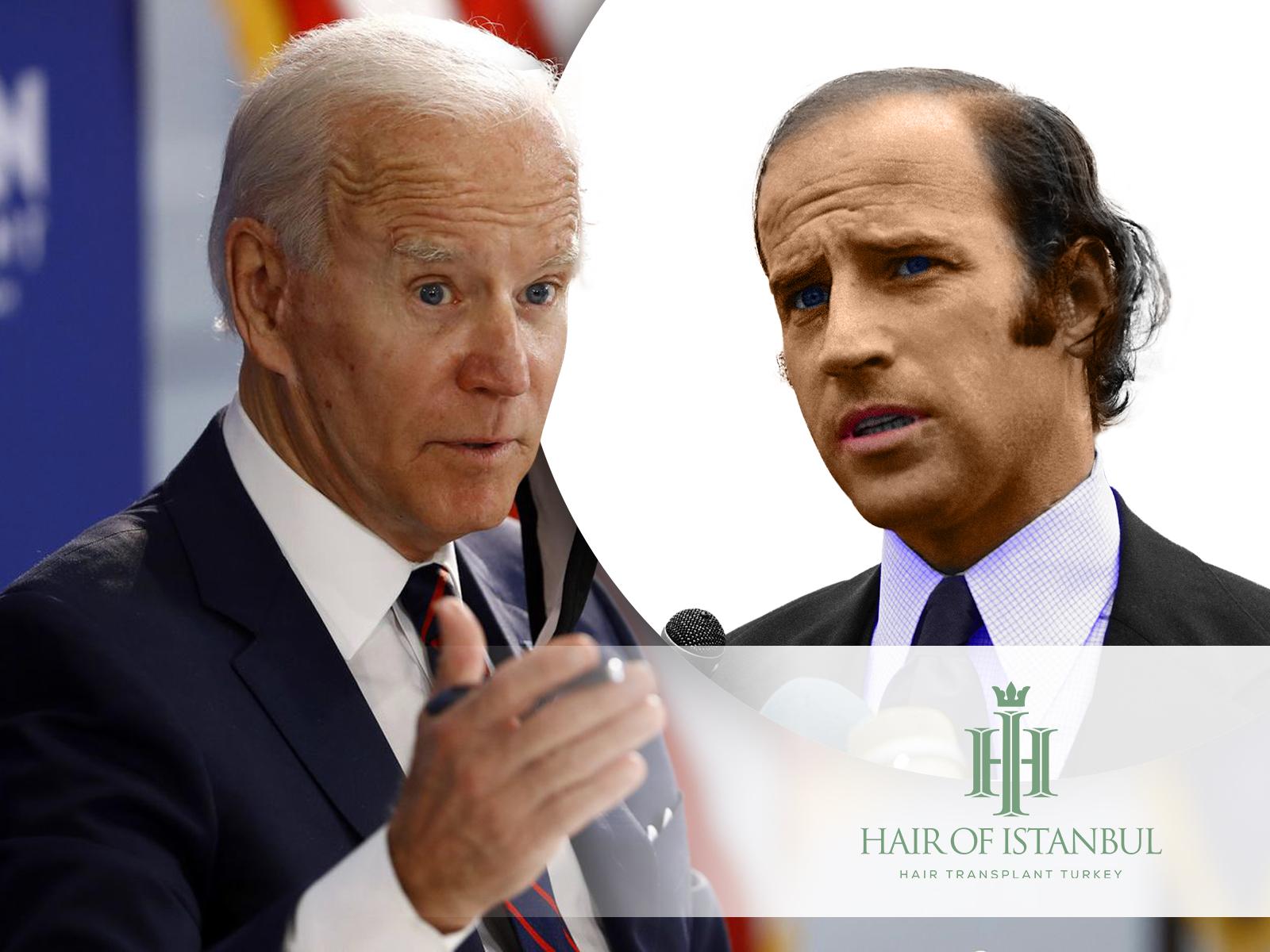 Joe Biden Hair Transplant: A Closer Look at the Evidence