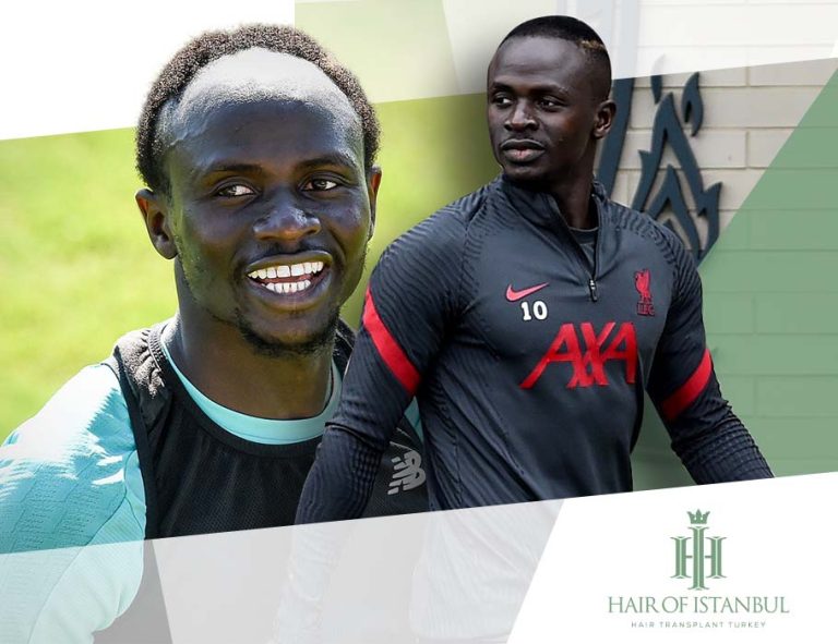 Sadio Mane Hair Transplantation Hair of Istanbul