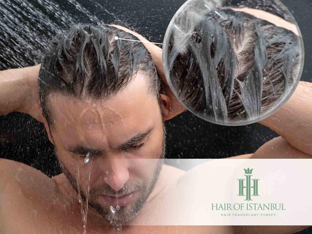 Is It Normal to See Your Scalp When Your Hair Is Wet?