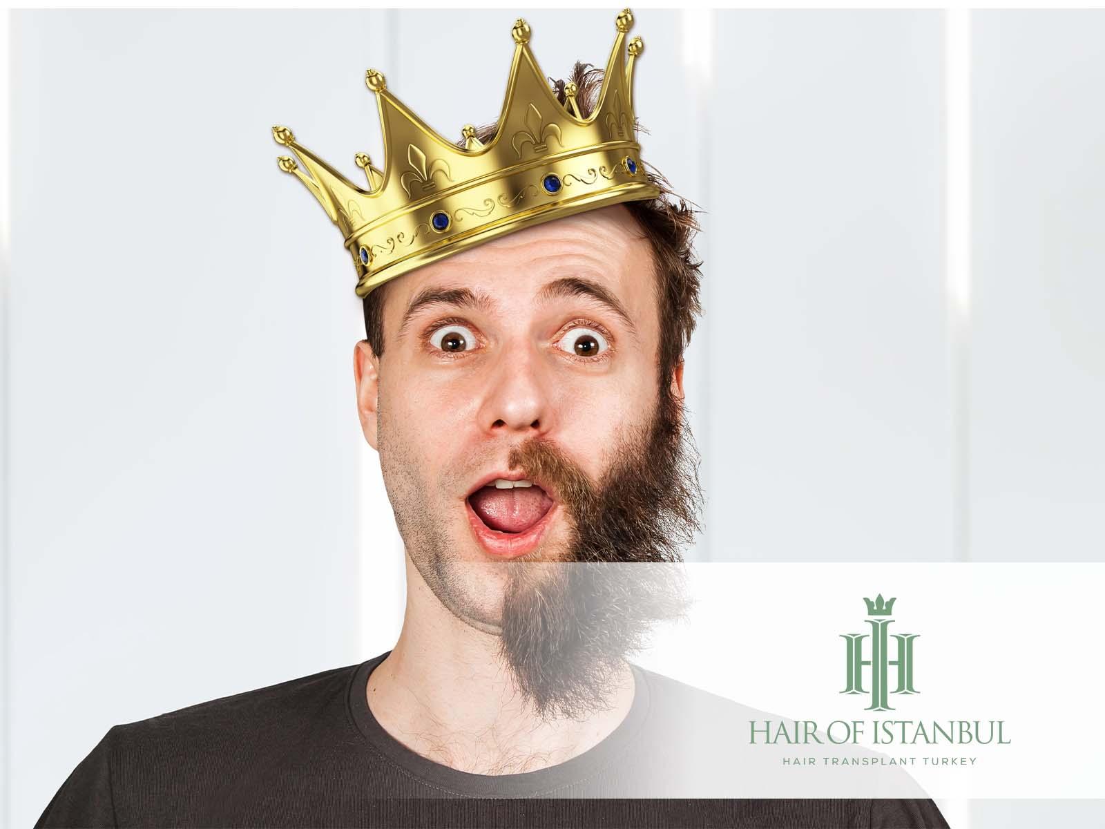 From Hero To Zero The Beard Transplant Gone Wrong