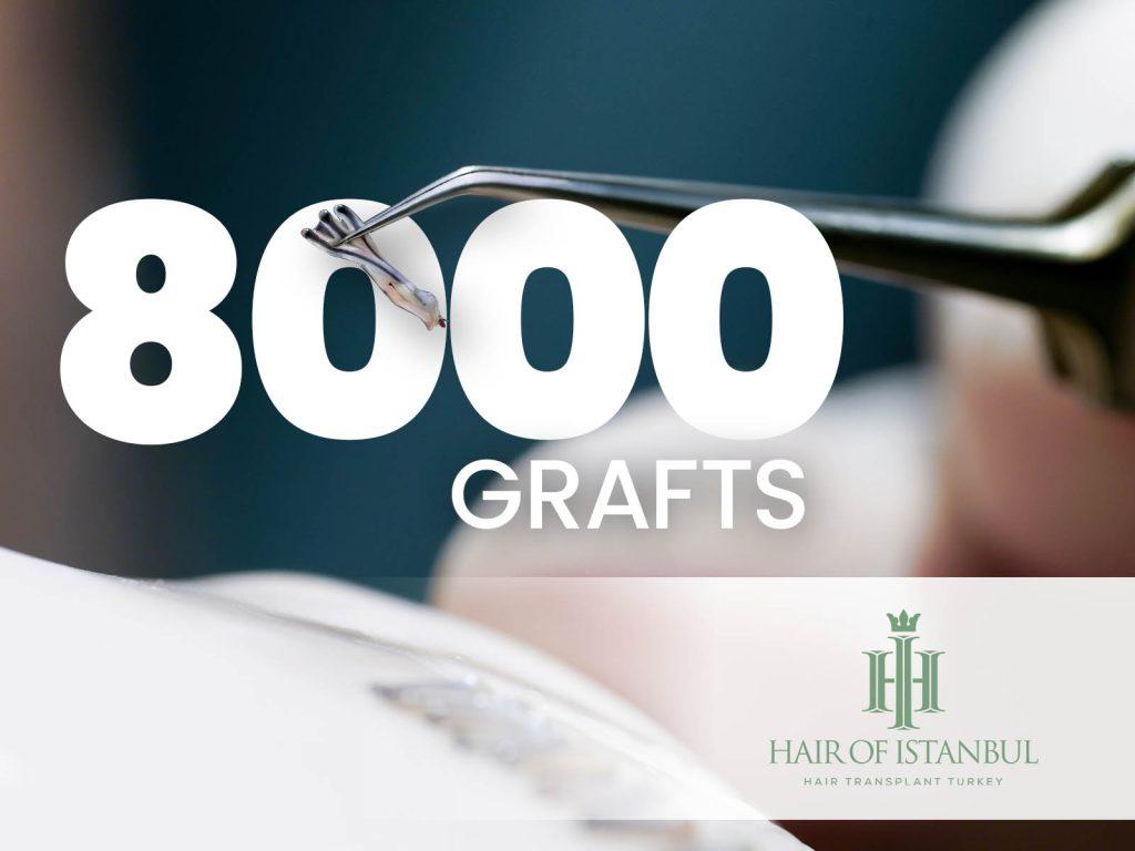 8000 Grafts in One Session: What the Donor Area Can Actually Give