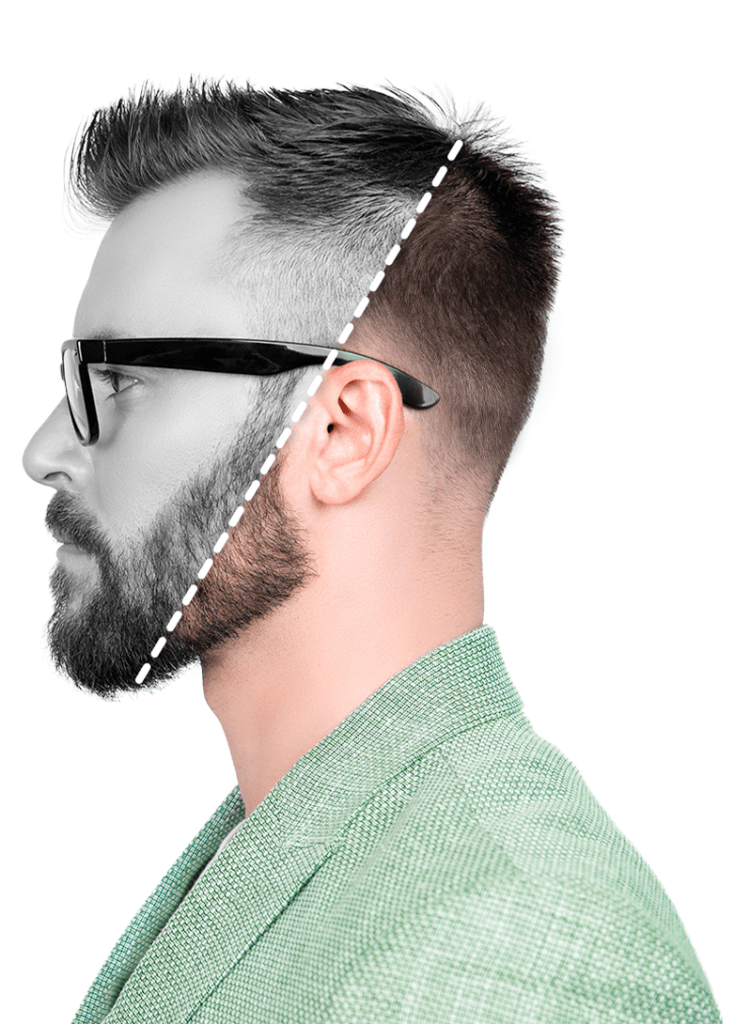 scalp micropigmentation