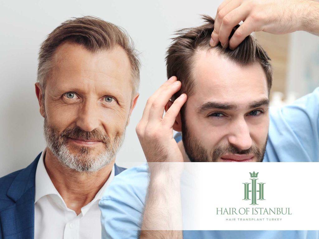 Mature Hairline vs Receding Hairline: How to Tell the Difference