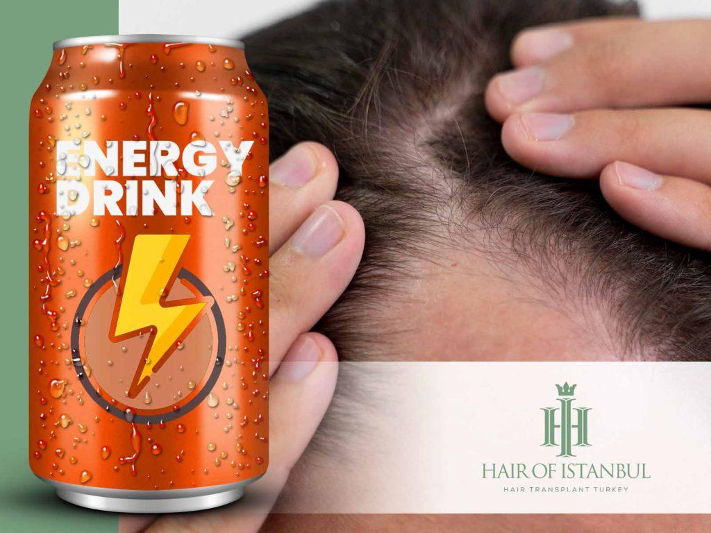 Do Energy Drinks Cause Hair Loss? Caffeine, Taurine and Sugar