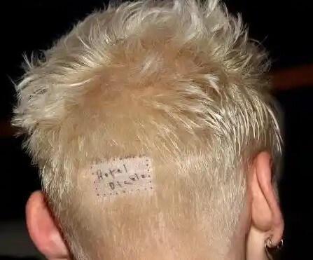 Machine Gun Kelly FUT hair transplant scar tattoo
