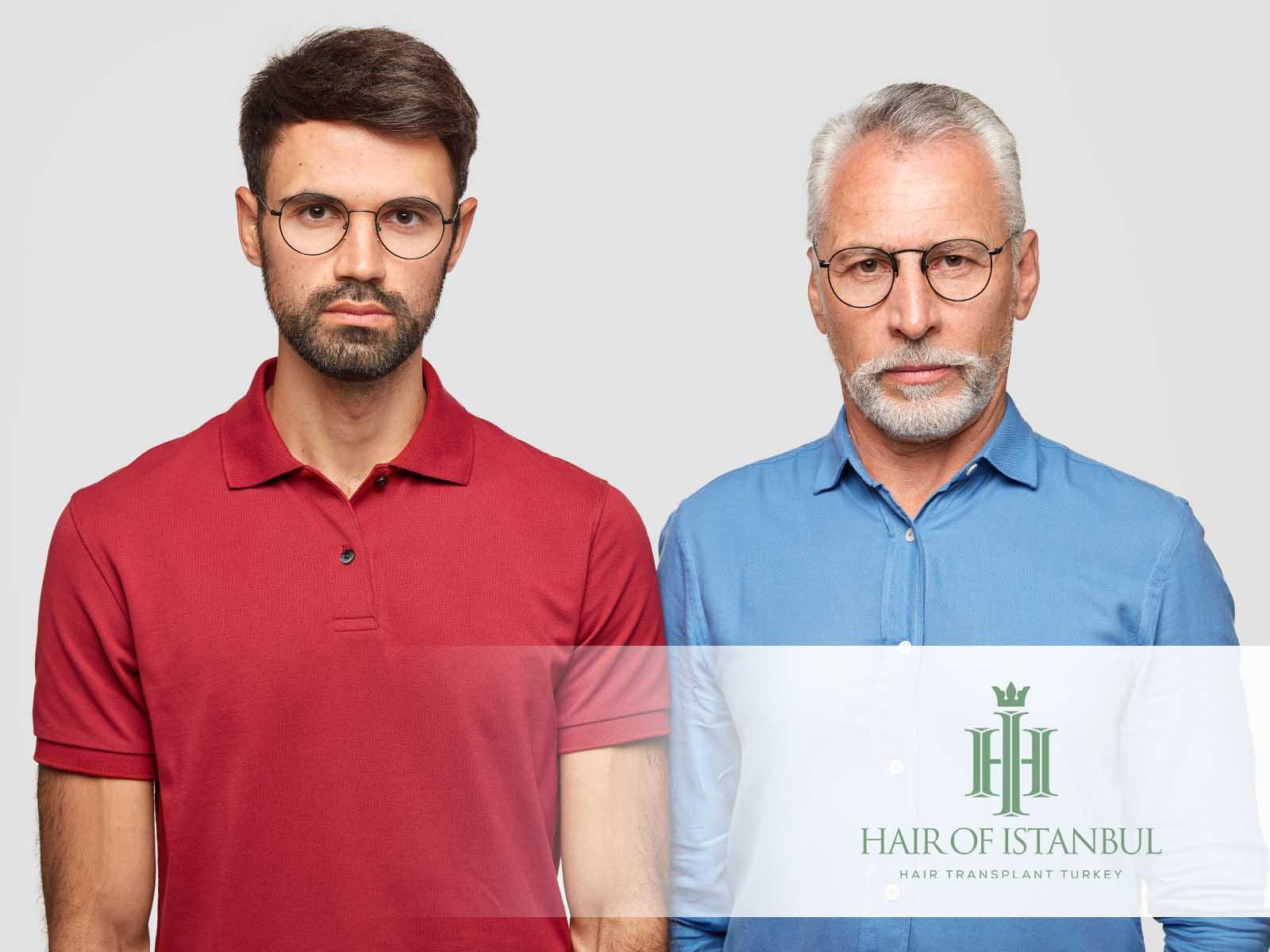 Ab wann ist eine Haartransplantation sinnvoll? Expertenrat holen!