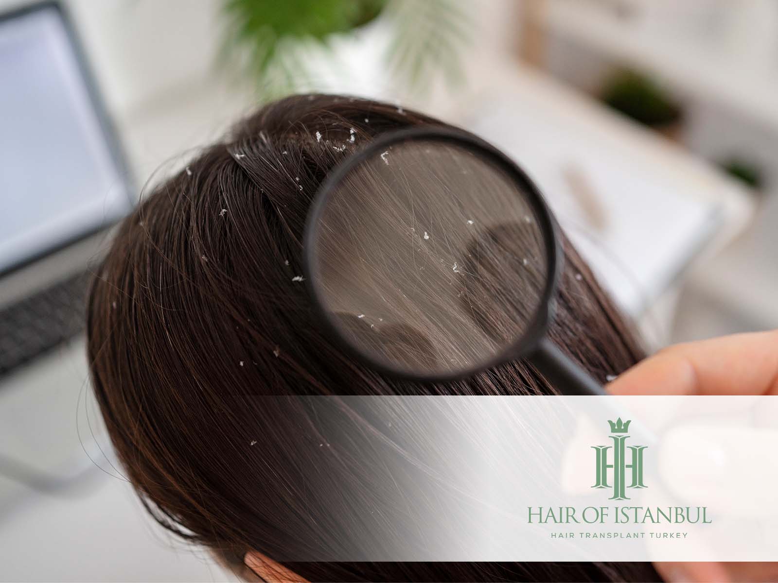 Sport nach Haartransplantation: Ab wann wieder erlaubt?