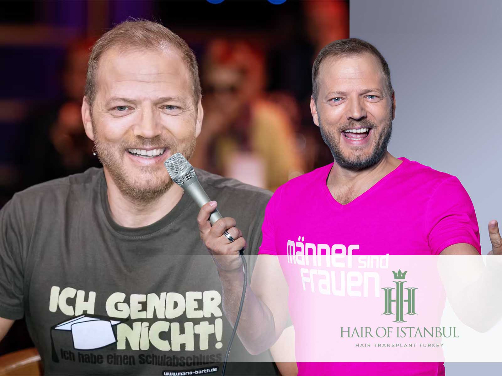 Mario Barth Haare: Hat er eine Haartransplantation gemacht?