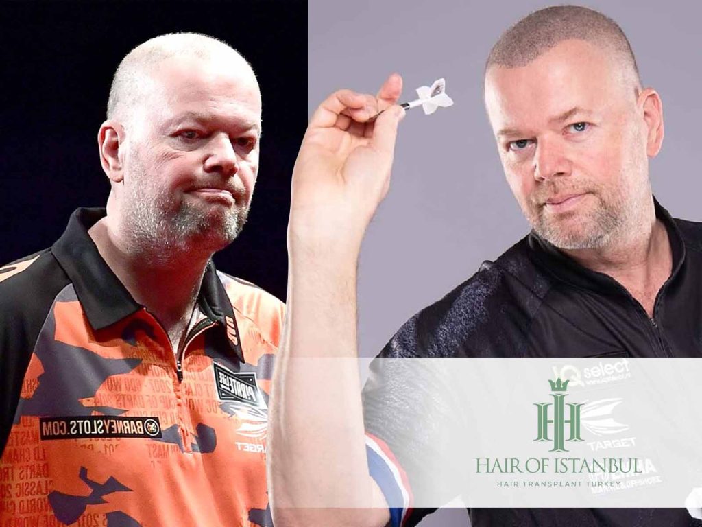 Wie Sich Raymond van Barnevelds Look Mit Den Jahren Verändert Hat 2 Raymond van Barneveld Hair