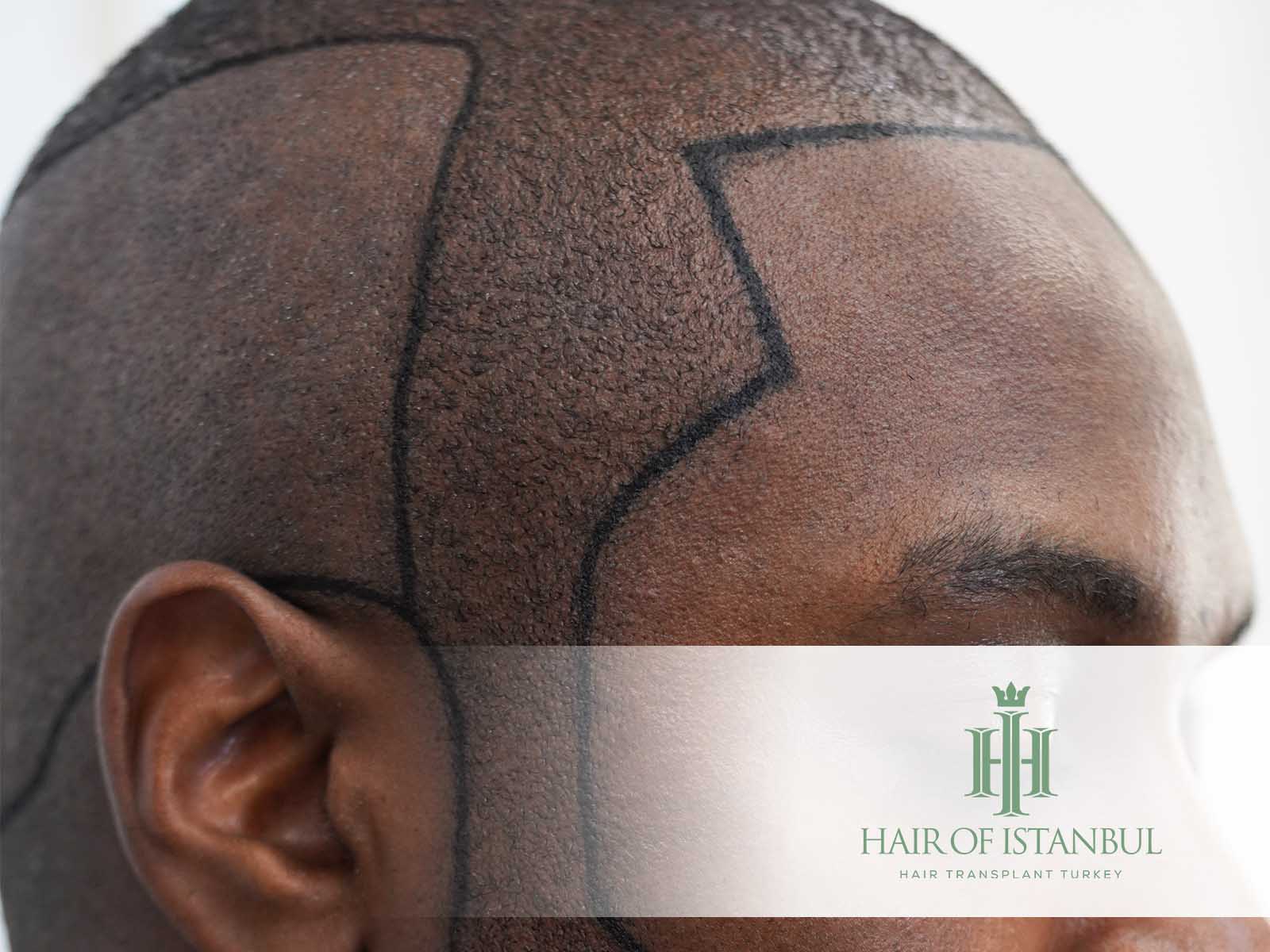 Afro-Haartyp bei Männern: Einzigartige Struktur verstehen