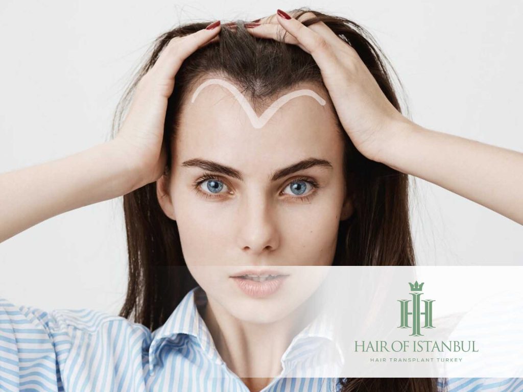 Is a Hair Transplant Permanent? Hair of Istanbul