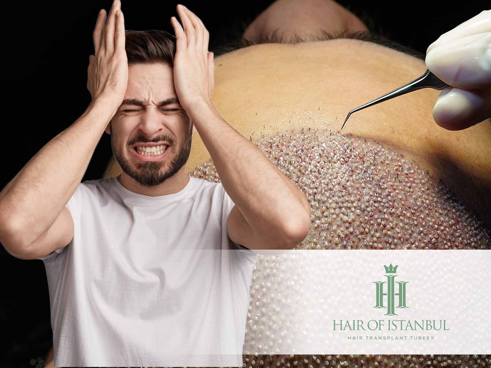 Ist eine Haartransplantation schmerzhaft? Was Sie wissen sollten