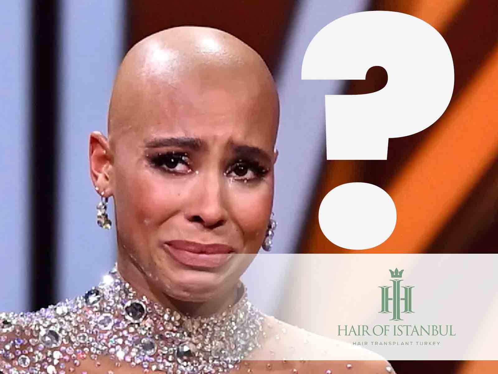 Warum hat Sharon Battiste keine Haare?