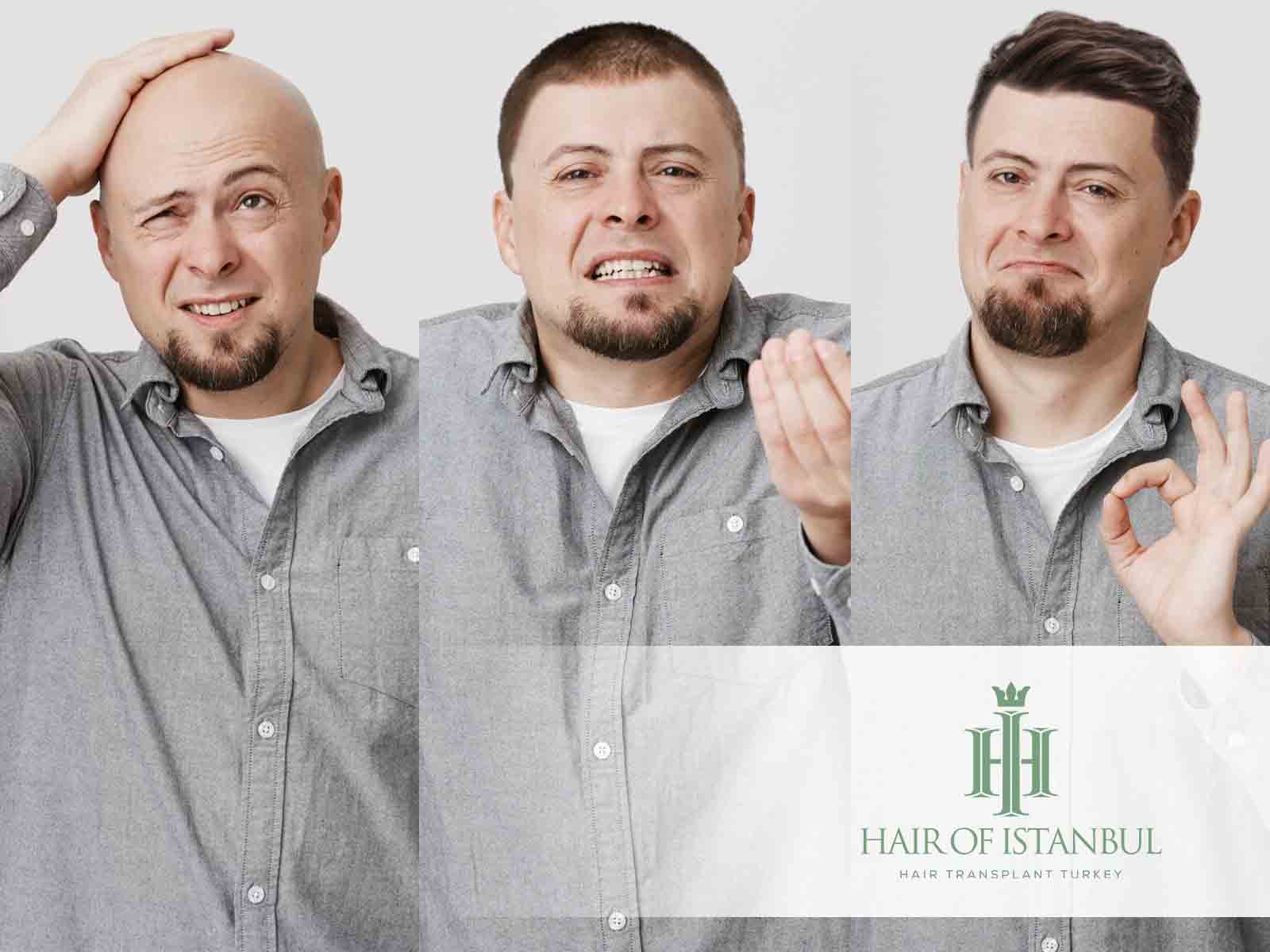Wie schnell wachsen Haare bei Männern? Jetzt herausfinden!