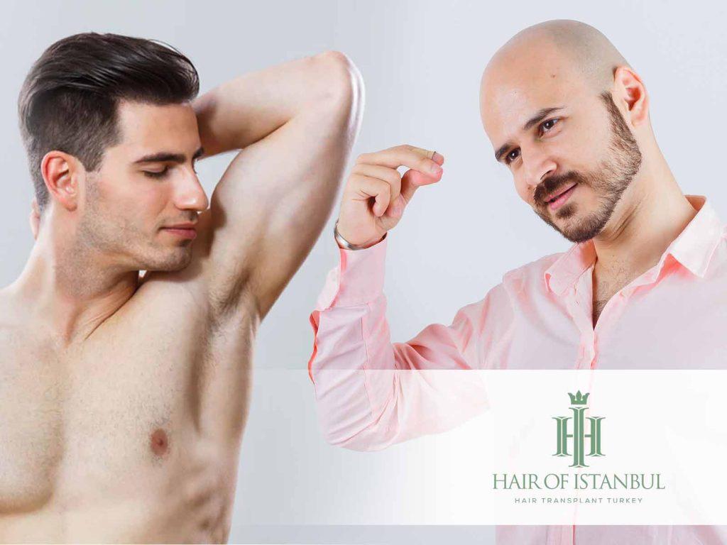 Armpit Hair Transplant: Why It Is Not a Donor Area
