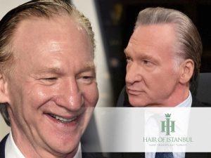 Bill Maher Hair Transplant: Facts, Myths & Expert Insights