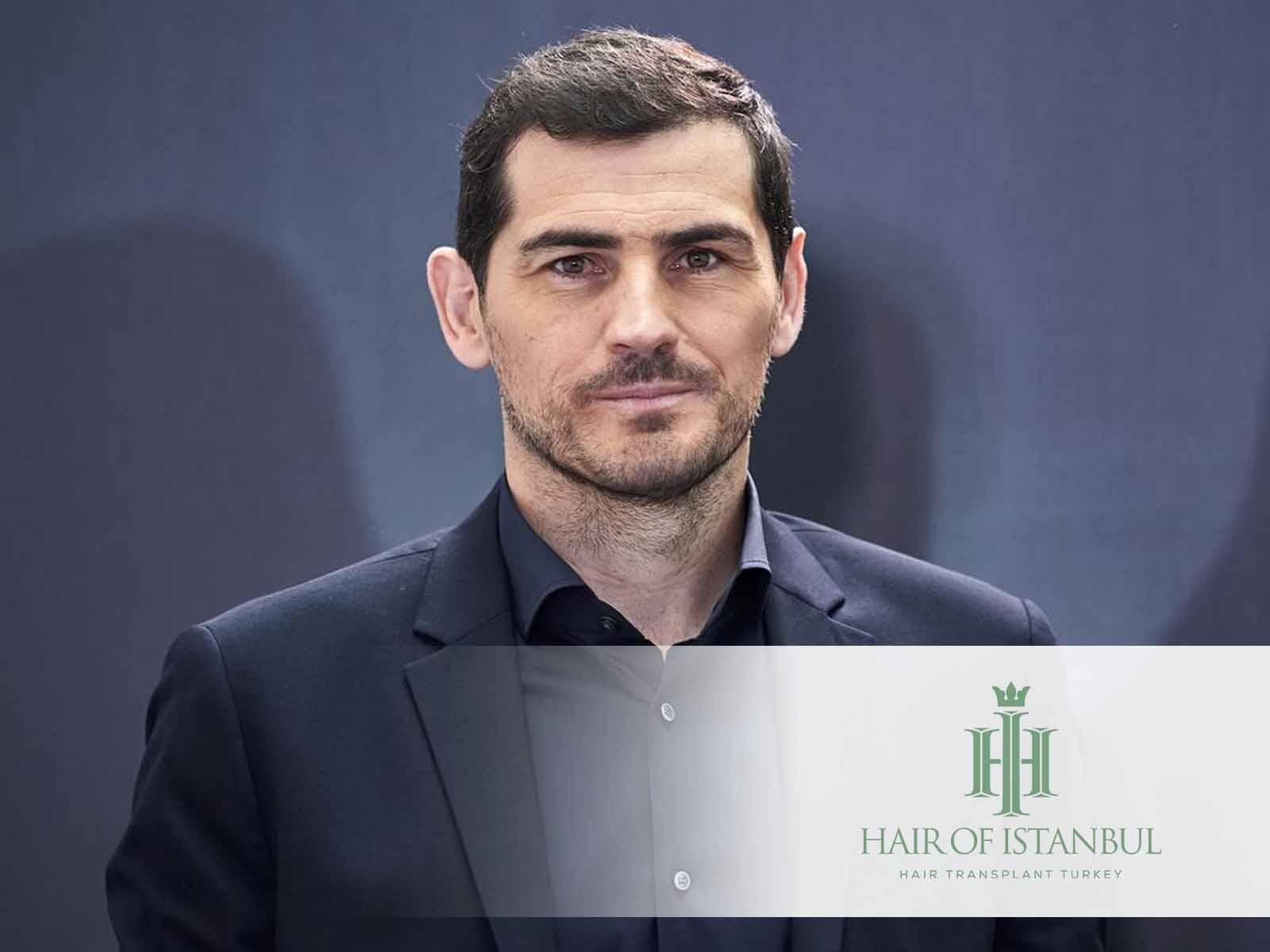 El injerto capilar de Iker Casillas: Rumores y realidades del pelo