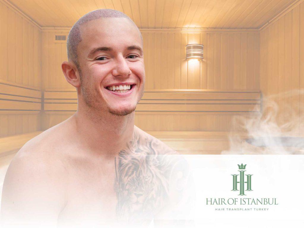 Sauna After Hair Transplant: Five Months, and Why