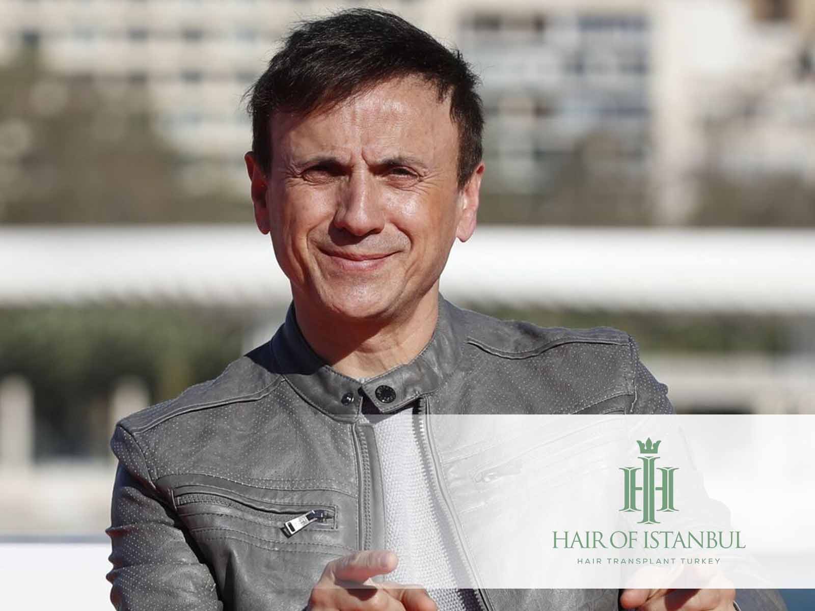 El injerto de pelo de José Mota: ¿mito o realidad?