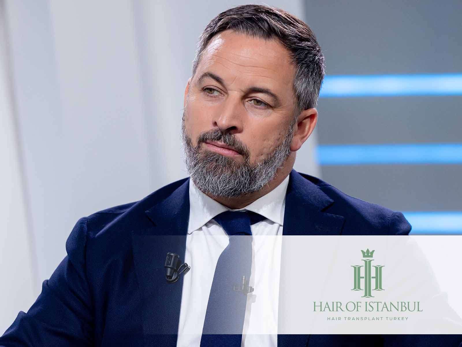 El injerto de pelo de Santiago Abascal: ¿Hecho o ficción?