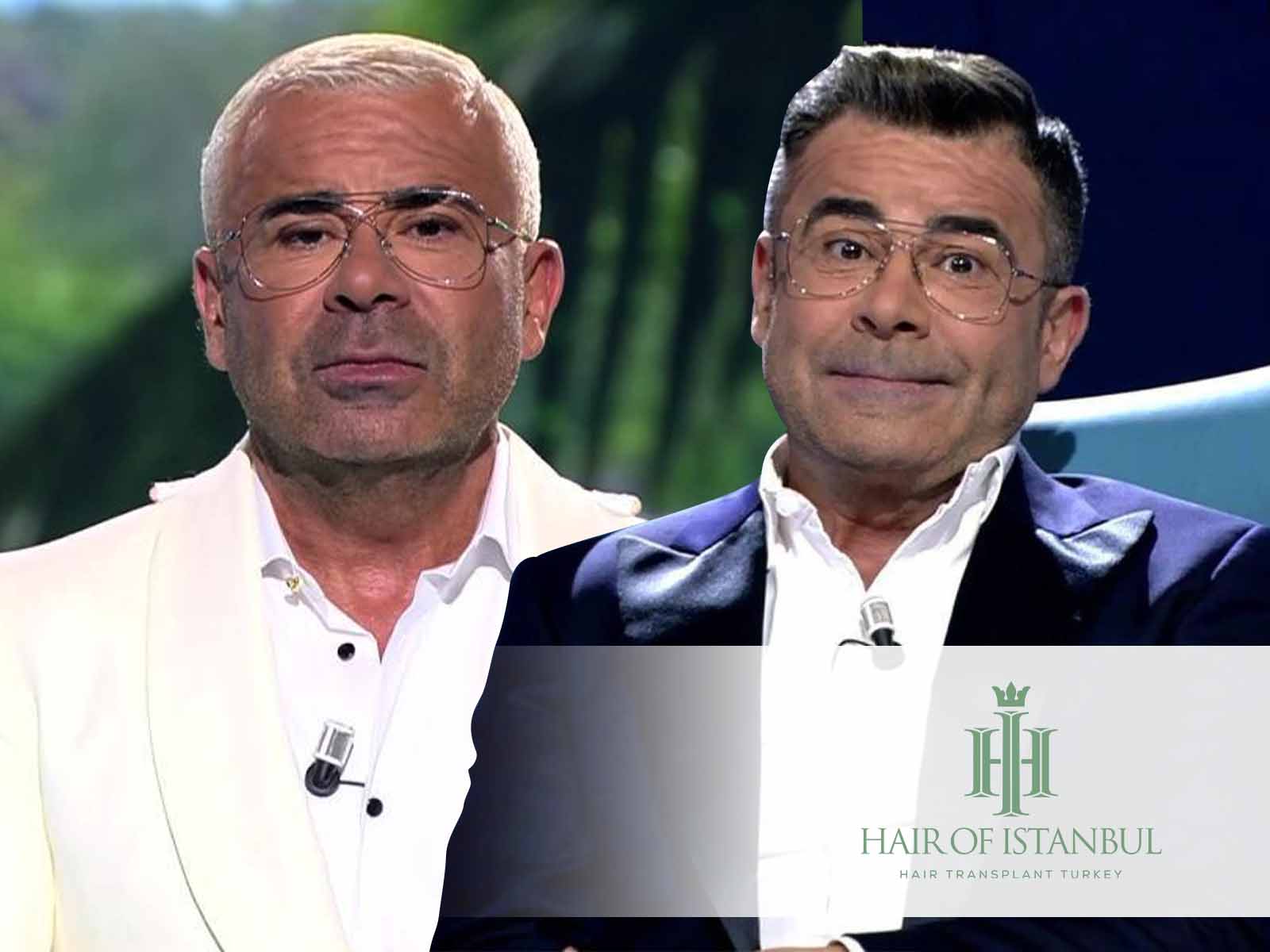 El posible injerto de pelo de Jorge Javier Vázquez