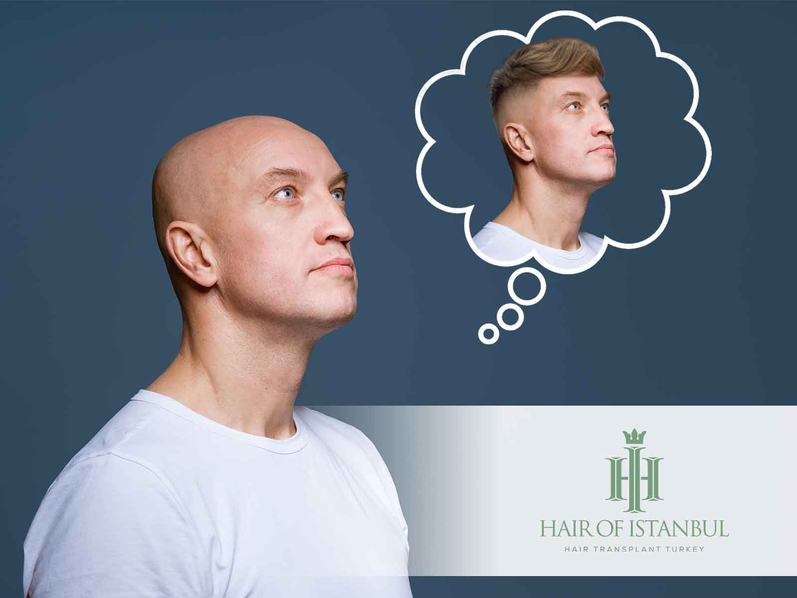 Haartransplantation bei Vollglatze möglich?