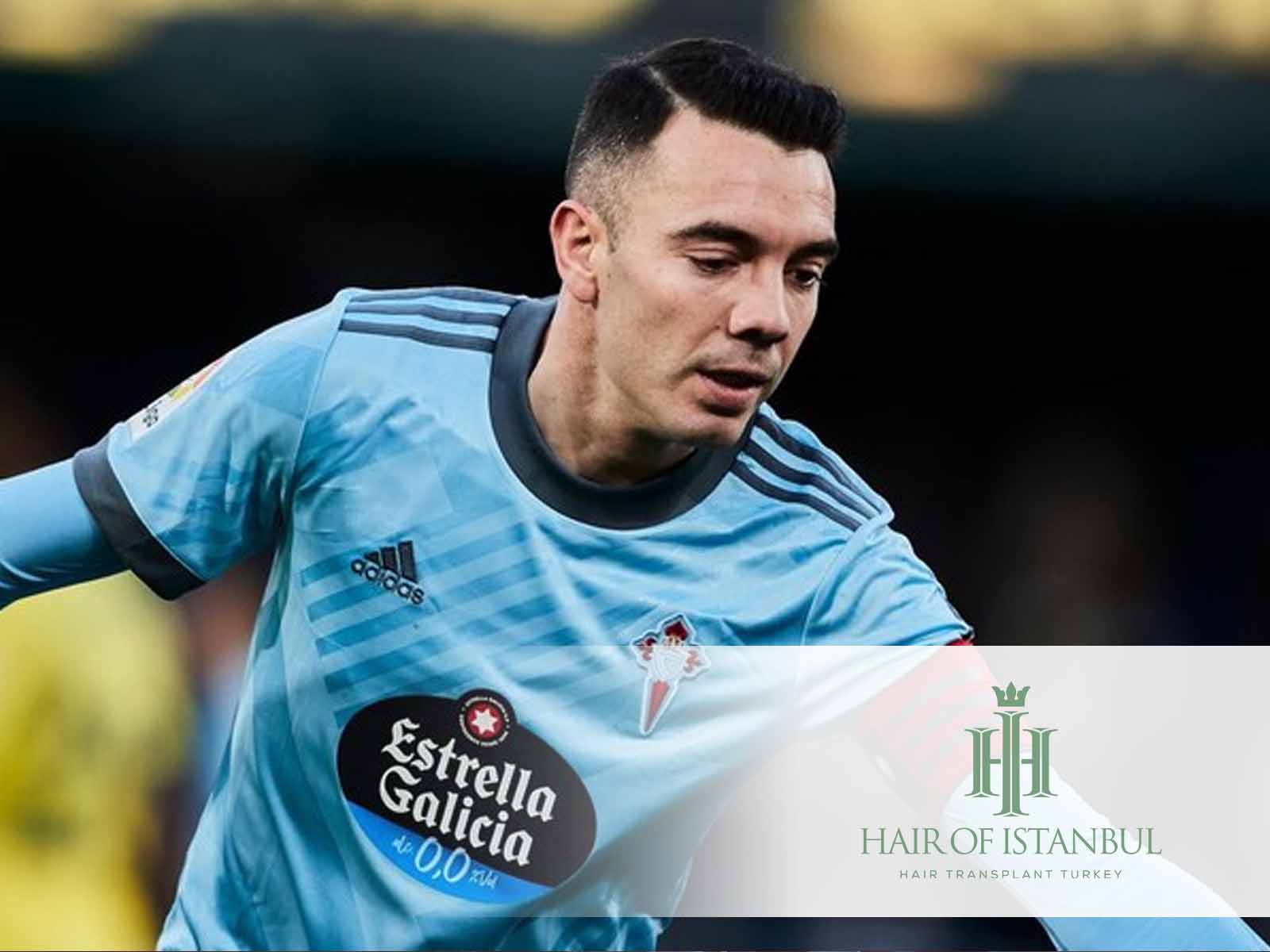 Iago Aspas y el injerto capilar: ¿Verdad o mito?