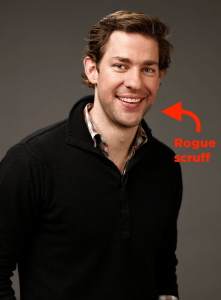 Krasinski’s Hair Transplant