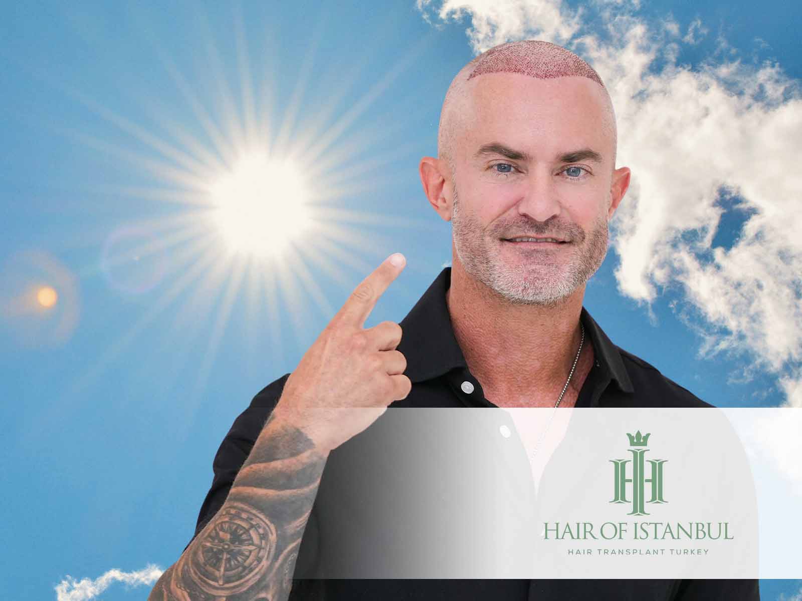 Sonne nach der Haartransplantation: Was ist zu beachten?