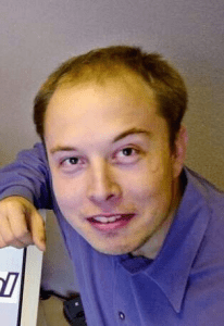 Greffe de cheveux à Elon Musk 