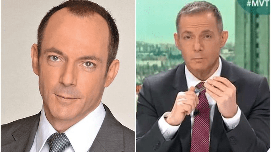 Hilario Pino y su injerto de pelo: fotos antes y después