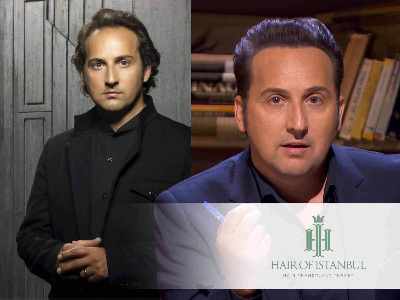 Iker Jiménez y el misterio del injerto de pelo: ¿Mito o realidad?