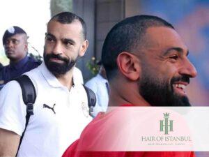 Mo Salah Hair Transplant: New Hairline Transformation