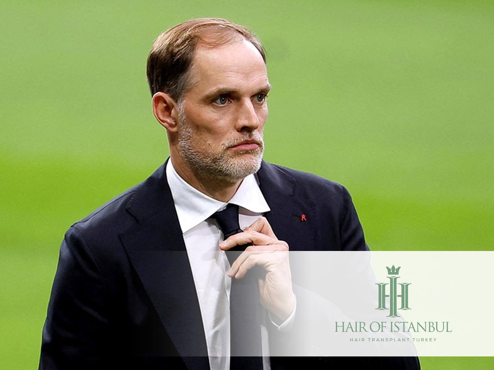 Thomas Tuchels Haarausfall eskaliert: Haartransplantation nötig?