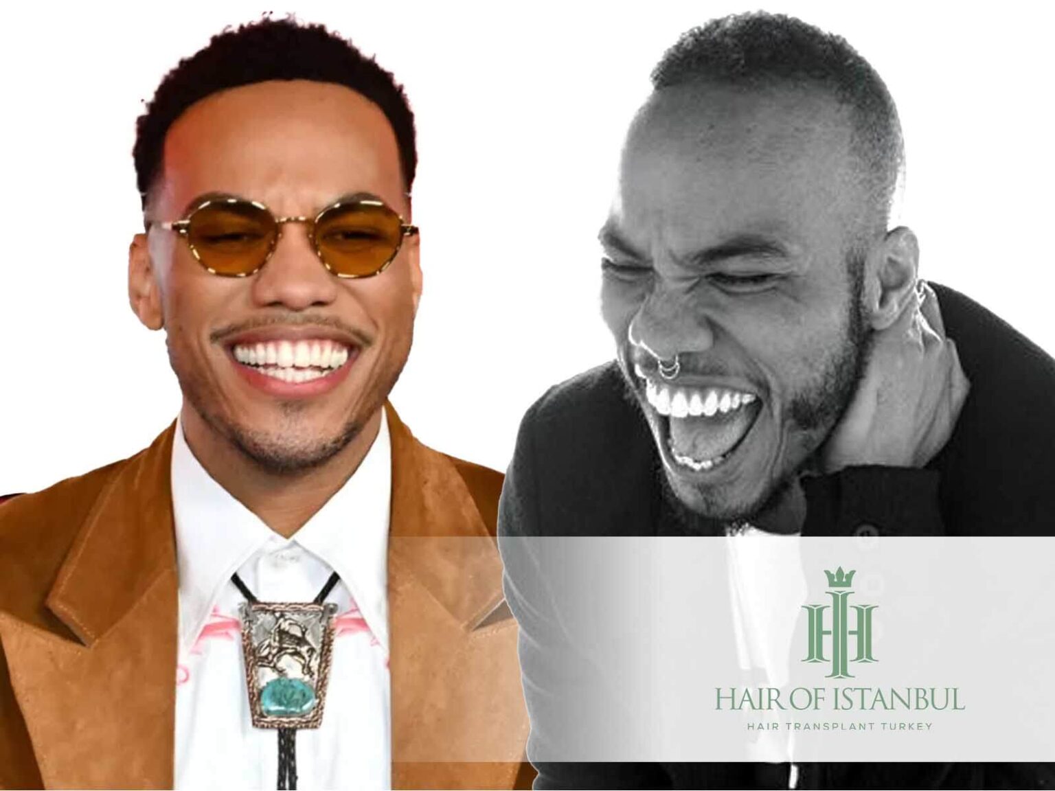 Anderson Paak Hair Transplant: The Truth Behind His Hair