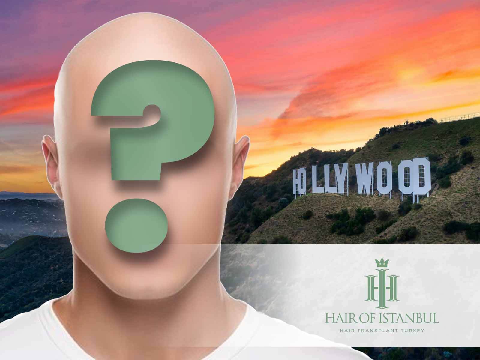 Hollywood Schauspieler mit Glatze