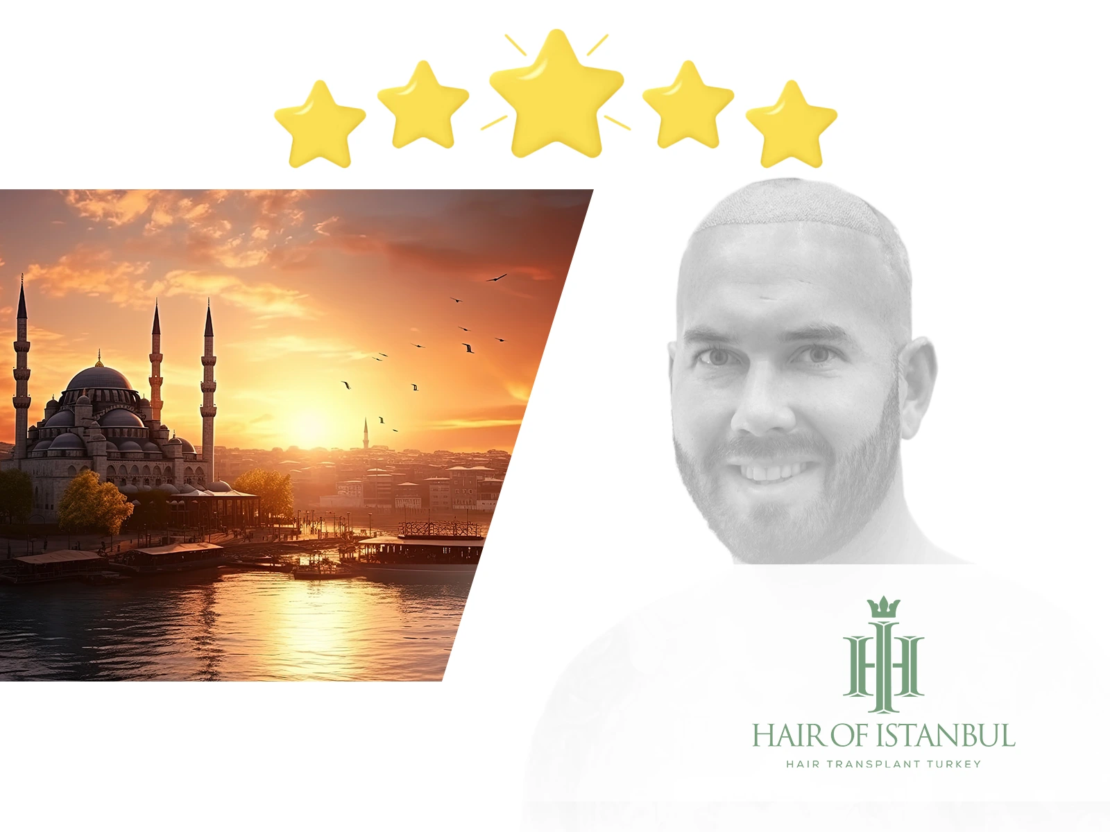 Best Hair Transplant Clinic in Turkey: 5 Star Rated Care