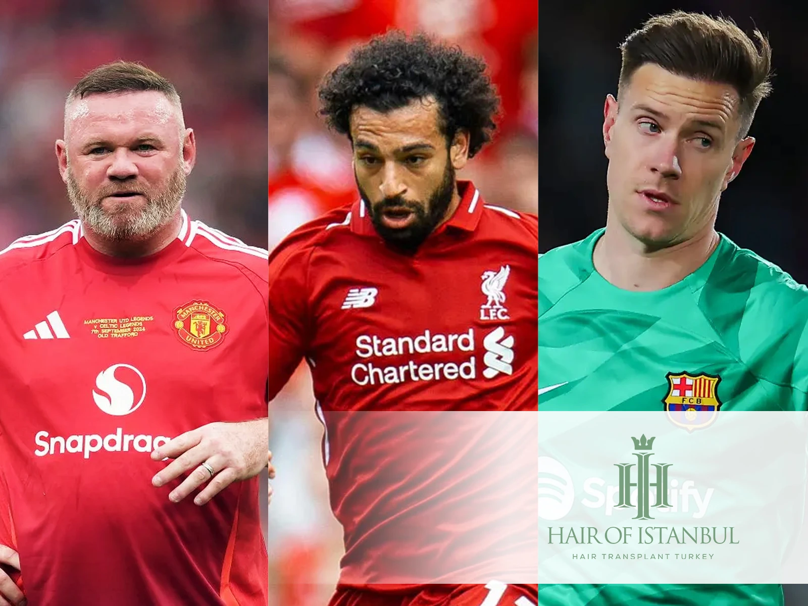 Hair Transplant Footballers in 2025: Who’s Next to Join the Trend?