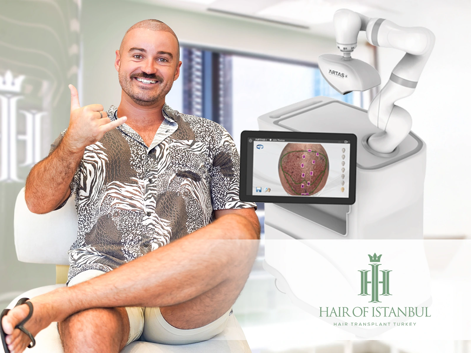 Robotic Hair Transplant: The Future of Precision Hair Restoration