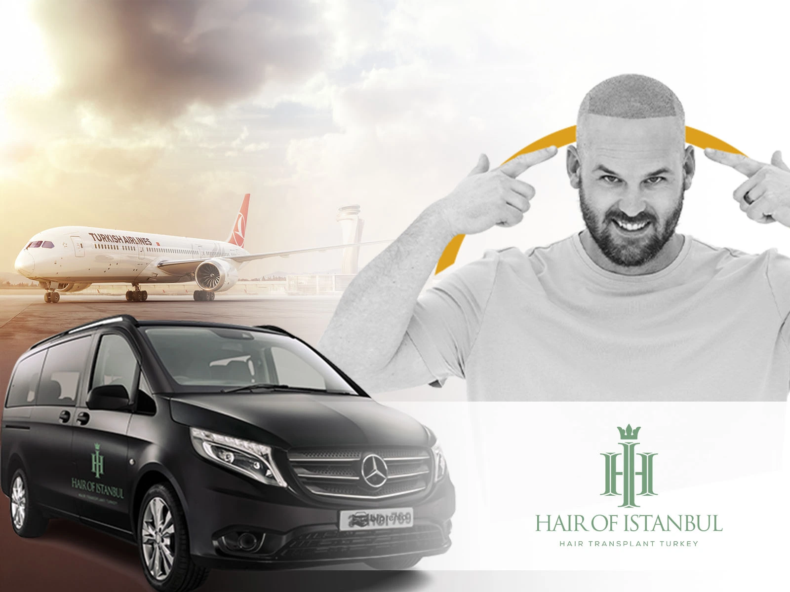 The 3-Day Hair Transplant Journey to Istanbul: A Guide for International Patients