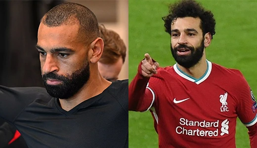 mo salah hair transplant