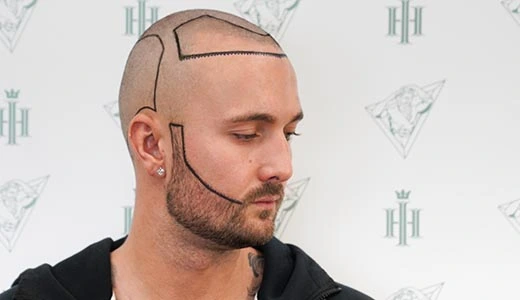 Beard Styles by Face Shape