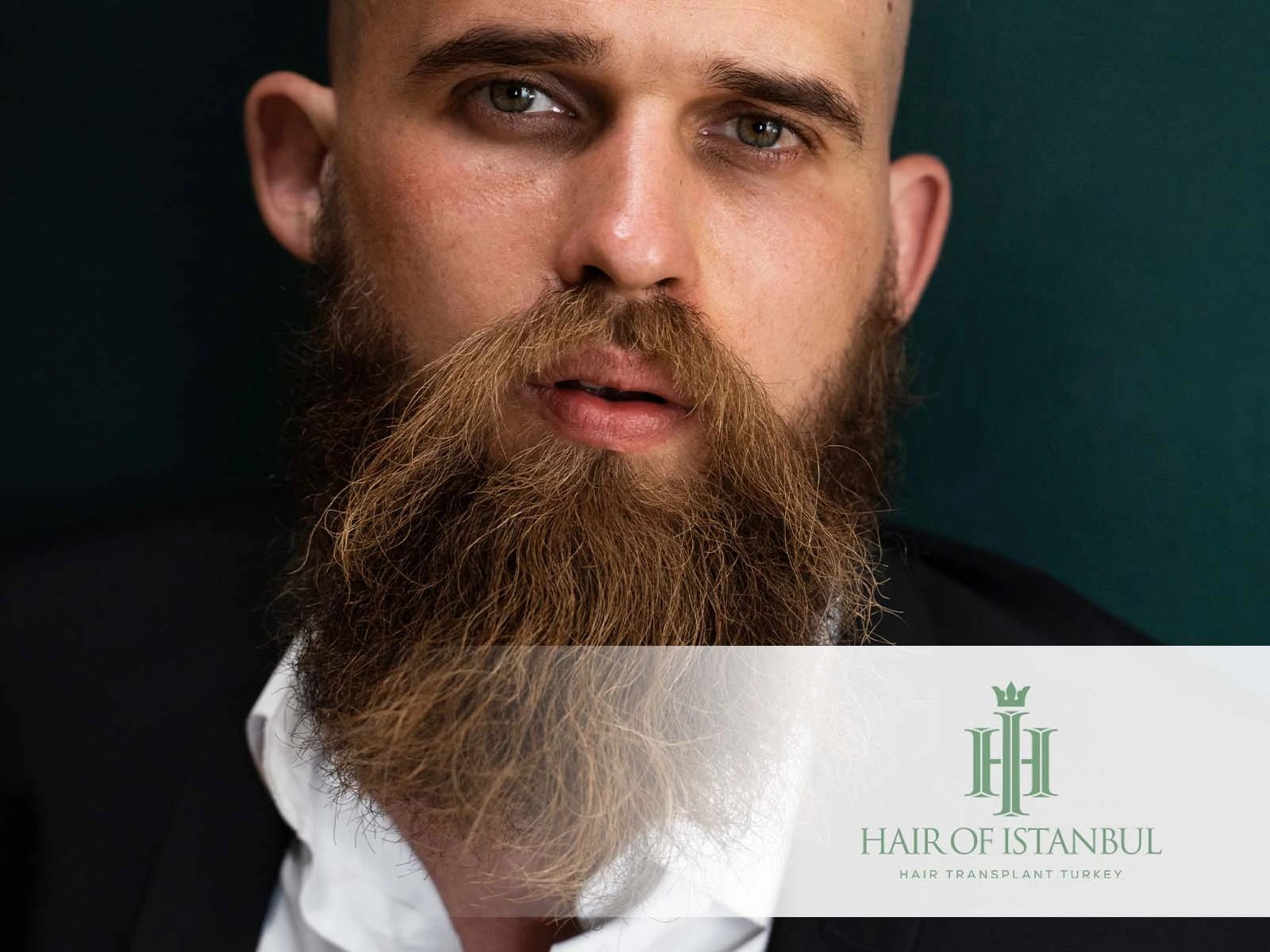 Beard Transplant Candidate: Are You the Right Fit for a Fuller Beard?