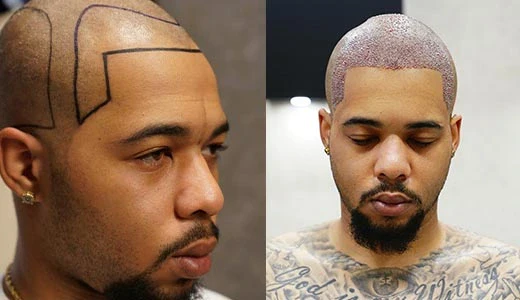 Day 0–7 The Critical Healing Phase